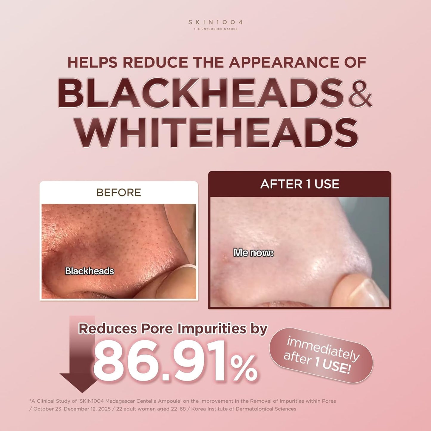 Pore Perfect Clay Mask